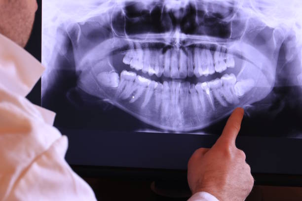 Best Emergency Treatment for Jaw Pain or Injury in Appleton, MN